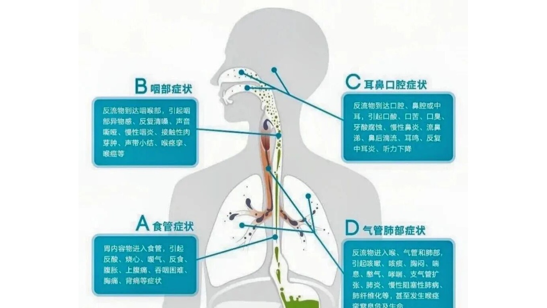 英雄联盟台服官网-盐巴戟天的作用与功效